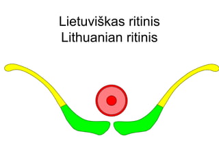 Lietuviškas ritinis
Lithuanian ritinis
 