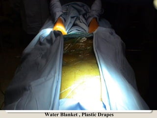 Water Blanket , Plastic Drapes
 