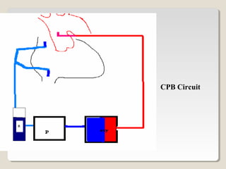 CPB Circuit
 