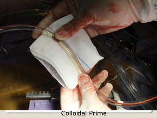 Colloidal Prime
 