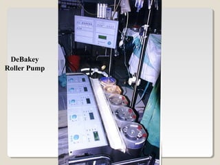 DeBakey
Roller Pump
 