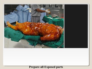 Prepare all Exposed parts
 