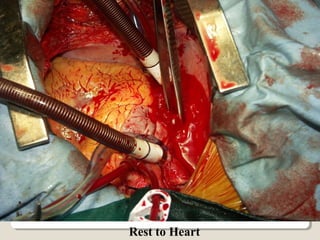 Rest to Heart
 