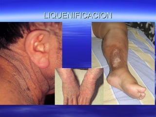 LIQUENIFICACION 