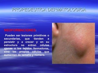 PROPEDEUTICA DERMATOLOGICA NEOFORMACIONES : Pueden ser lesiones primitivas o secundarias, que tienden a persistir y a crecer y en su estructura no entran células ajenas a los tejidos formadores, sino las propias células que aumentan de tamaño y número. 