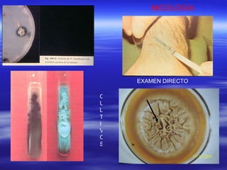 MICOLOGIA EXAMEN DIRECTO CULTIVOS 