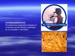 CITODIAGNÓSTICO : Procedimiento diagnóstico basado en el examen de las células contenidas en un exudado o trasudado. 
