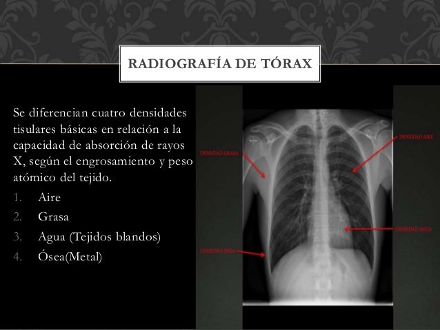 Proyecciones Radiologicas