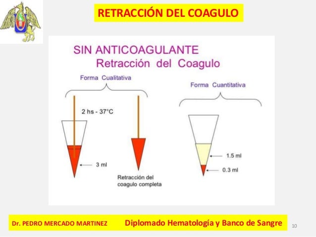 Cuanto Tarda En Deshacerse Un Coágulo