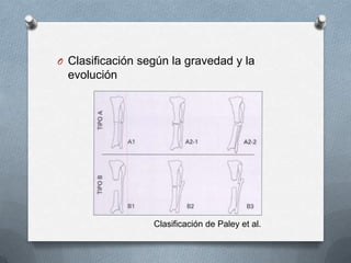 O Clasificación según la gravedad y la
evolución
Clasificación de Paley et al.
 