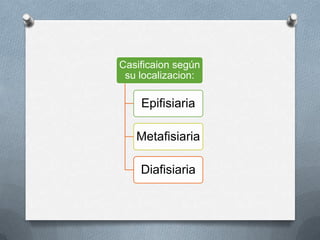 Casificaion según
su localizacion:
Epifisiaria
Metafisiaria
Diafisiaria
 