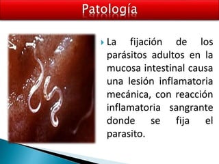 La fijación de los
parásitos adultos en la
mucosa intestinal causa
una lesión inflamatoria
mecánica, con reacción
inflamatoria sangrante
donde se fija el
parasito.
 