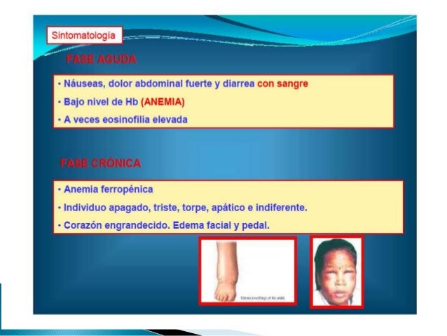 Clase 10 uncinariasis