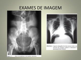 EXAMES DE IMAGEM
 