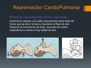 Reanimación CardioPulmonarRealizar hiperextensión de las vías aéreaExtienda la cabeza y el cuello suavemente hacia atrás de forma que se abra  la boca y favorecer el flujo de aire. Observe el movimiento de tórax, escuche los ruidos respiratorios y sienta si hay salida de aire.