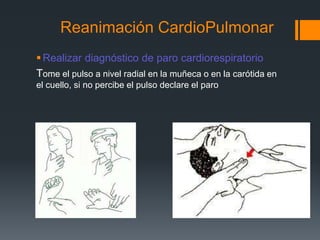 Reanimación CardioPulmonarRealizar diagnóstico de paro cardiorespiratorioTome el pulso a nivel radial en la muñeca o en la carótida en el cuello, si no percibe el pulso declare el paro