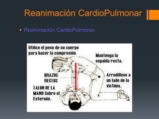Reanimación CardioPulmonar Reanimación CardioPulmonar