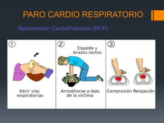 PARO CARDIO RESPIRATORIOReanimación CardioPulmonar (RCP)