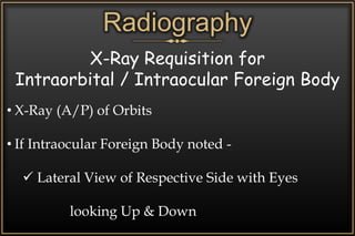 Radiography
X-Ray Requisition for
Intraorbital / Intraocular Foreign Body
• X-Ray (A/P) of Orbits
• If Intraocular Foreign Body noted -
 Lateral View of Respective Side with Eyes
looking Up & Down
 