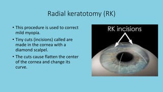 Refractive error | PPTX