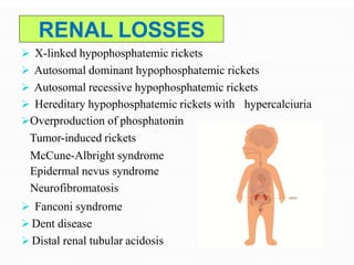 RENAL LOSSES
 X-linked hypophosphatemic rickets
 Autosomal dominant hypophosphatemic rickets
 Autosomal recessive hypophosphatemic rickets
hypercalciuria Hereditary hypophosphatemic rickets with
Overproduction of phosphatonin
Tumor-induced rickets
McCune-Albright syndrome
Epidermal nevus syndrome
Neurofibromatosis
 Fanconi syndrome
 Dent disease
 Distal renal tubular acidosis
 