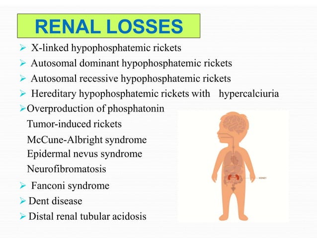RICKETS IN CHILDREN | PPTX | Bone and Joint Conditions | Diseases and ...