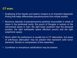CT scan:
• Scalloping of the hepatic and splenic margins is an important diagnostic
finding that helps differentiate pseudomyxoma from simple ascites.
• Mucinous deposits of pseudomyxoma peritonei accumulate in areas of
stasis in the peritoneal cavity: the pouch of Douglas in women or the
retrovesical space in men, the right lower quadrant near the ileocecal
junction, the right subhepatic space (Morison pouch) and the right
subphrenic space.
• Mucin within the peritoneum is usually low in CT attenuation, but areas
of soft-tissue attenuation may be present that represent solid tumor
elements, fibrosis or compression of the mesentery.
• Curvilinear or amorphous calcifications may be present.
 