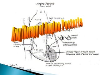 Drug Therapy of Angina Pectoris 