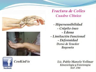 Fractura de Colles 
