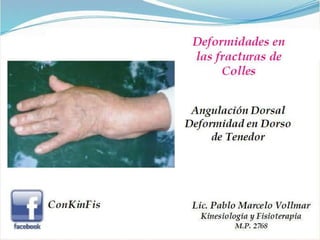 Fractura de Colles 