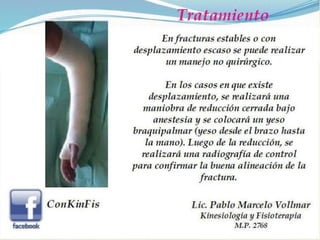 Fractura de Colles 