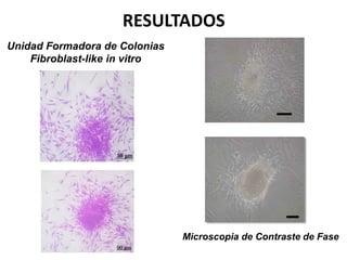 Unidad Formadora de Colonias
Fibroblast-like in vitro
Microscopia de Contraste de Fase
RESULTADOS
 
