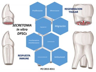 PCI 2015-8311
Diferenciación
REGENERACION
TISULAR
Proliferación
Angiogénesis
SECRETOMA
in vitro
DPSCs
Migración
Comunicación
Proinflamatorio
Antiinflamatorio
Inmunomodulación
RESPUESTA
INMUNE
Antitumoral
 
