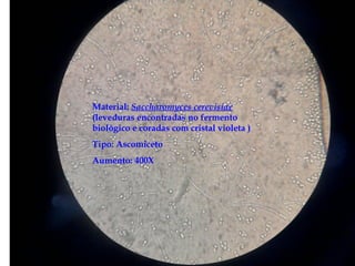 Reino Fungi
Material: Saccharomyces cerevisiae
(leveduras encontradas no fermento
biológico e coradas com cristal violeta )
Tipo: Ascomiceto
Aumento: 400X
 