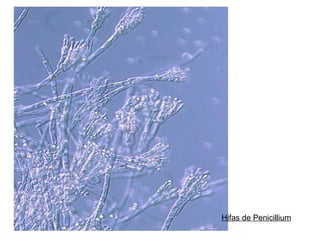 Hifas de Penicillium
 