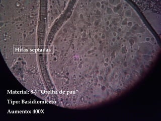 Hifas septadas
Material: 8-) “Orelha de pau”
Tipo: Basidiomiceto
Aumento: 400X
 