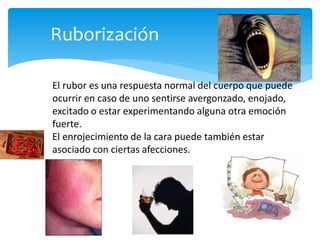 2 sintomas endocrinos
