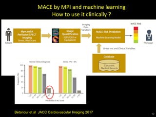 12
MACE by MPI and machine learning
How to use it clinically ?
Betancur et al JACC Cardiovascular Imaging 2017
 