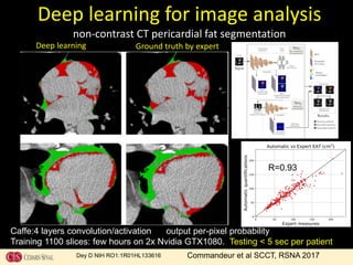 Deep learning for image analysis
non-contrast CT pericardial fat segmentation
Ground truth by expertDeep learning
Dey D NIH RO1:1R01HL133616
Caffe:4 layers convolution/activation output per-pixel probability
Training 1100 slices: few hours on 2x Nvidia GTX1080. Testing < 5 sec per patient
Commandeur et al SCCT, RSNA 2017
R=0.93
R=0.95
 