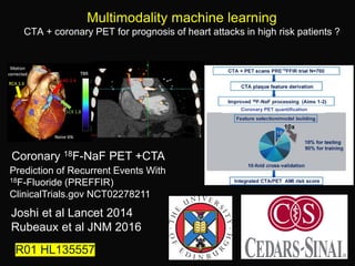 Multimodality machine learning
CTA + coronary PET for prognosis of heart attacks in high risk patients ?
Coronary 18F-NaF PET +CTA
Coronary PET quantification
Prediction of Recurrent Events With
18F-Fluoride (PREFFIR)
ClinicalTrials.gov NCT02278211
Joshi et al Lancet 2014
Rubeaux et al JNM 2016
R01 HL135557
 
