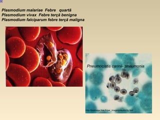 Plasmodium malariae Febre quartã
Plasmodium vivax Febre terçã benigna
Plasmodium falciparum febre terçã maligna
Pneumocistis carinii- pneumonia
http://bioimage.free.fr/par_image/pneumo3g.htm
 