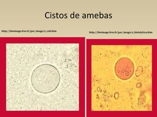Cistos de amebas
http://bioimage.free.fr/par_image/e_coli.htm http://bioimage.free.fr/par_image/e_histolytica.htm
 