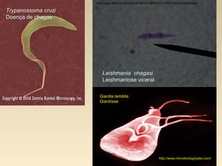 http://www.flickr.com/photos/45081031@N04/4141599759/in/photostream/
Leishmania chagasi
Leishmaniose viceral
Trypanossoma cruzi
Doença de chagas
http://www.microbiologybytes.com/
Giardia lamblia
Giardíase
 
