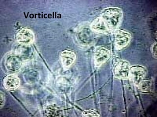 Vorticella
 