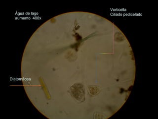 Água de lago
aumento 400x
Vorticella
Ciliado pedicelado
Diatomácea
 