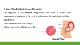 2 STAGE OF LABOUR Physiology (Mechanism of labour).pptx ( Ms. Shweta ...