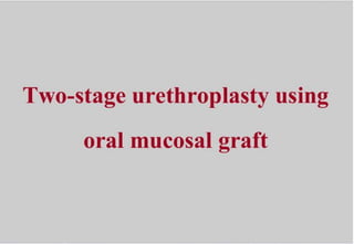 2 stage urethroplasty using oral mucosa