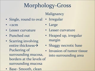Morphology-Gross Single, round to oval <2cm Lesser curvature Punched out Scarring involving entire thickness   Puckering of surrounding mucosa, borders at the levels of surrounding mucosa Base- Smooth, clean Malignancy Irregular Large Lesser curvature Heaped up, irregular margin Shaggy necrotic base Invasion of tumor tissue into surrounding area 