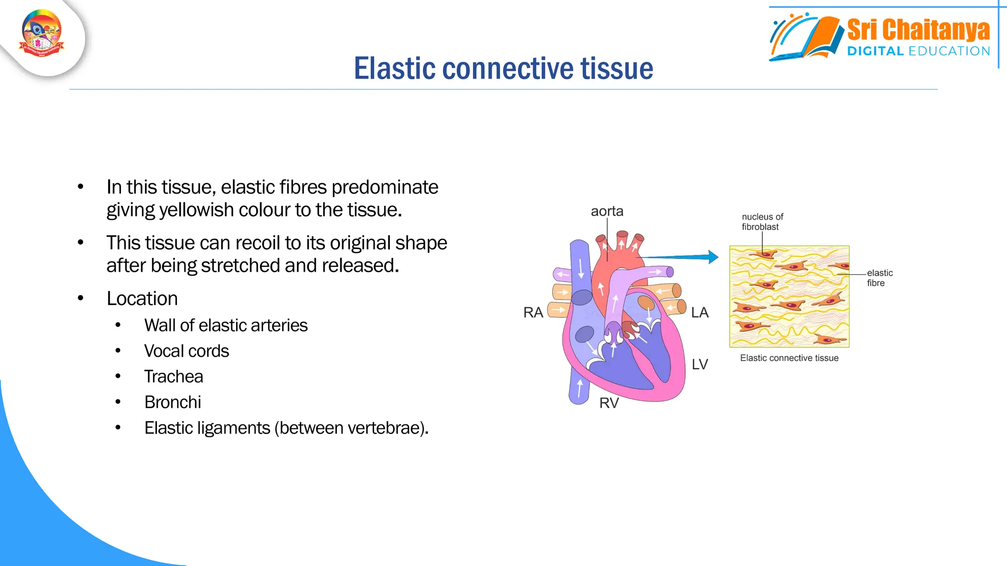 Elastic connective tissue
• In this tissue, elastic fibres predominate
giving yellowish colour to the tissue.
• This tissue can recoil to its original shape
after being stretched and released.
• Location
• Wall of elastic arteries
• Vocal cords
• Trachea
• Bronchi
• Elastic ligaments (between vertebrae).
 