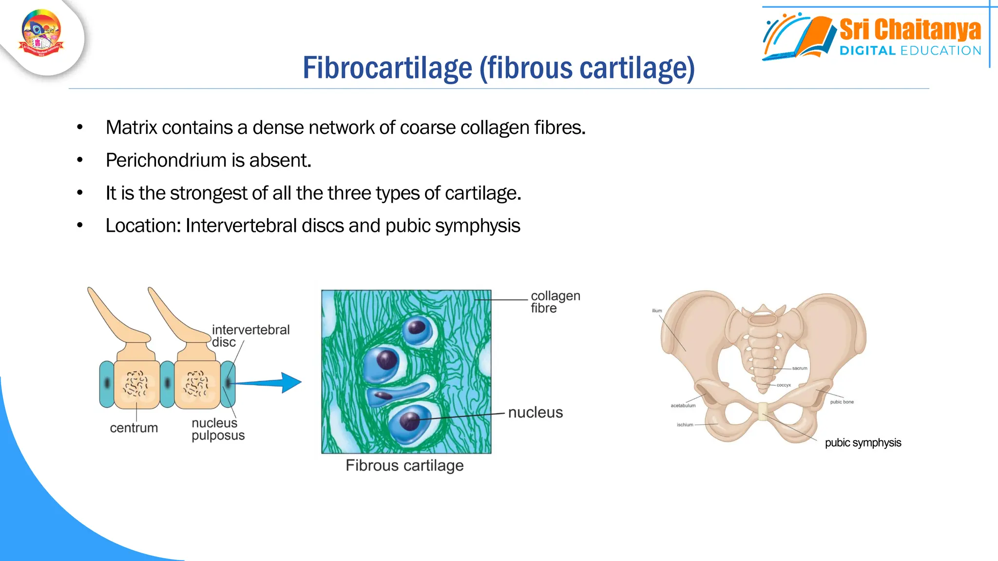 Fibrocartilage (fibrous cartilage)
• Matrix contains a dense network of coarse collagen fibres.
• Perichondrium is absent.
• It is the strongest of all the three types of cartilage.
• Location: Intervertebral discs and pubic symphysis
pubic symphysis
 
